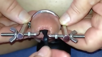 Insertion urethra, de pene